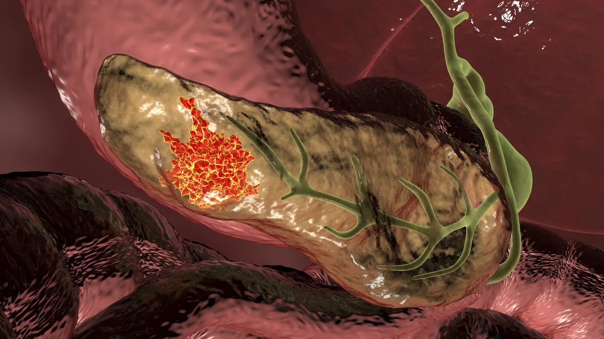 cancer patient — IN news